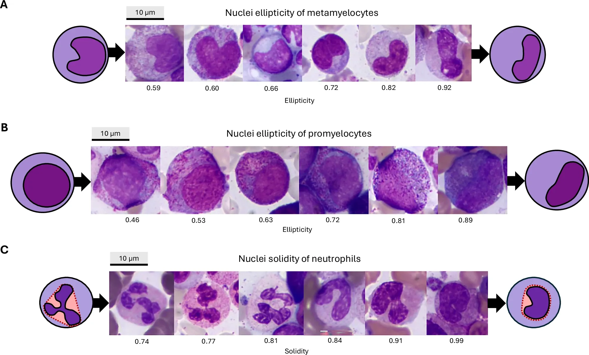 Scientific illustration of metamyelocytes, promyelocytes and neutrophils with different types of nuclei, from Nature Journal.