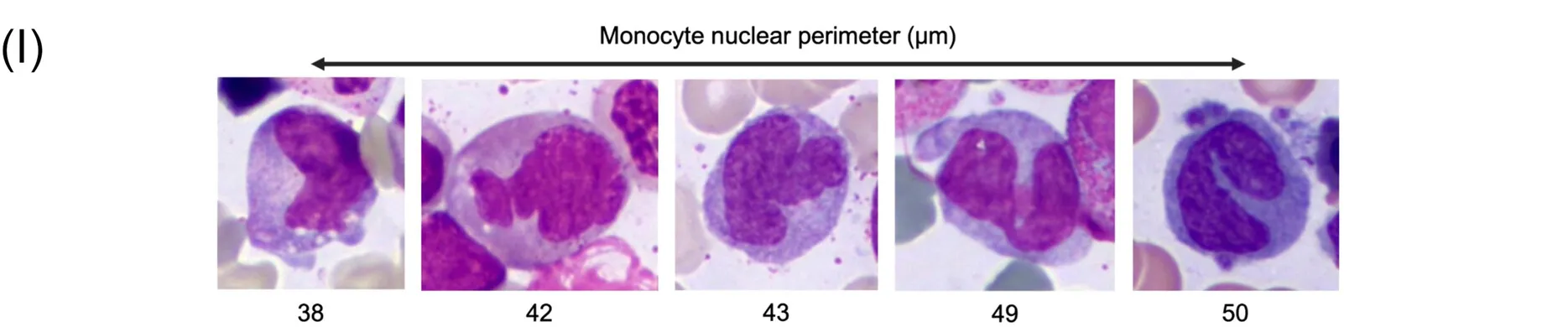 Scientific illustration of monocytes with various nuclei perimeter sizes, from Wiley Online Library.
