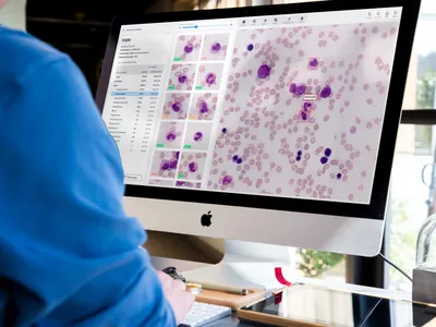 Doctor looking at cell labels viewed with Cellbytes.