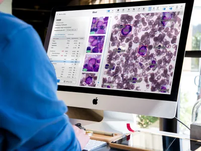 Doctor looking at cell labels viewed with Cellbytes.