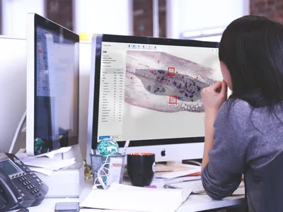 Doctor looking at a sample with an overlaid mask viewed with Cellbytes.