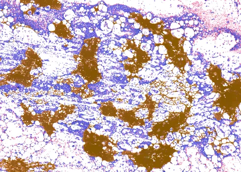 A screenshot of Cellbytes showing slide texture overlay mask.