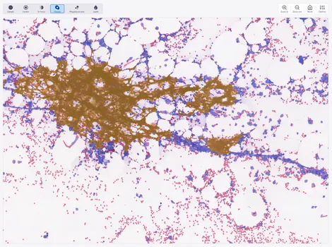 A screenshot of Cellbytes showing slide texture overlay mask.