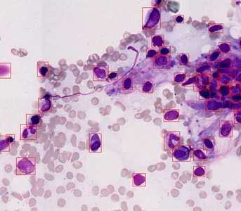 100 times magnified image of blood cells, with annotated bounding boxes around white blood cells labeled by Cellbytes.