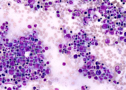 100 times magnified image of blood cells, with annotated bounding boxes around white blood cells labeled by Cellbytes.