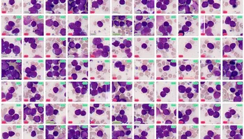 Screenshot from the Cellbytes software from view similar cells, showcasing a big grid of cells of blasts, artefacts and lymphocytes.