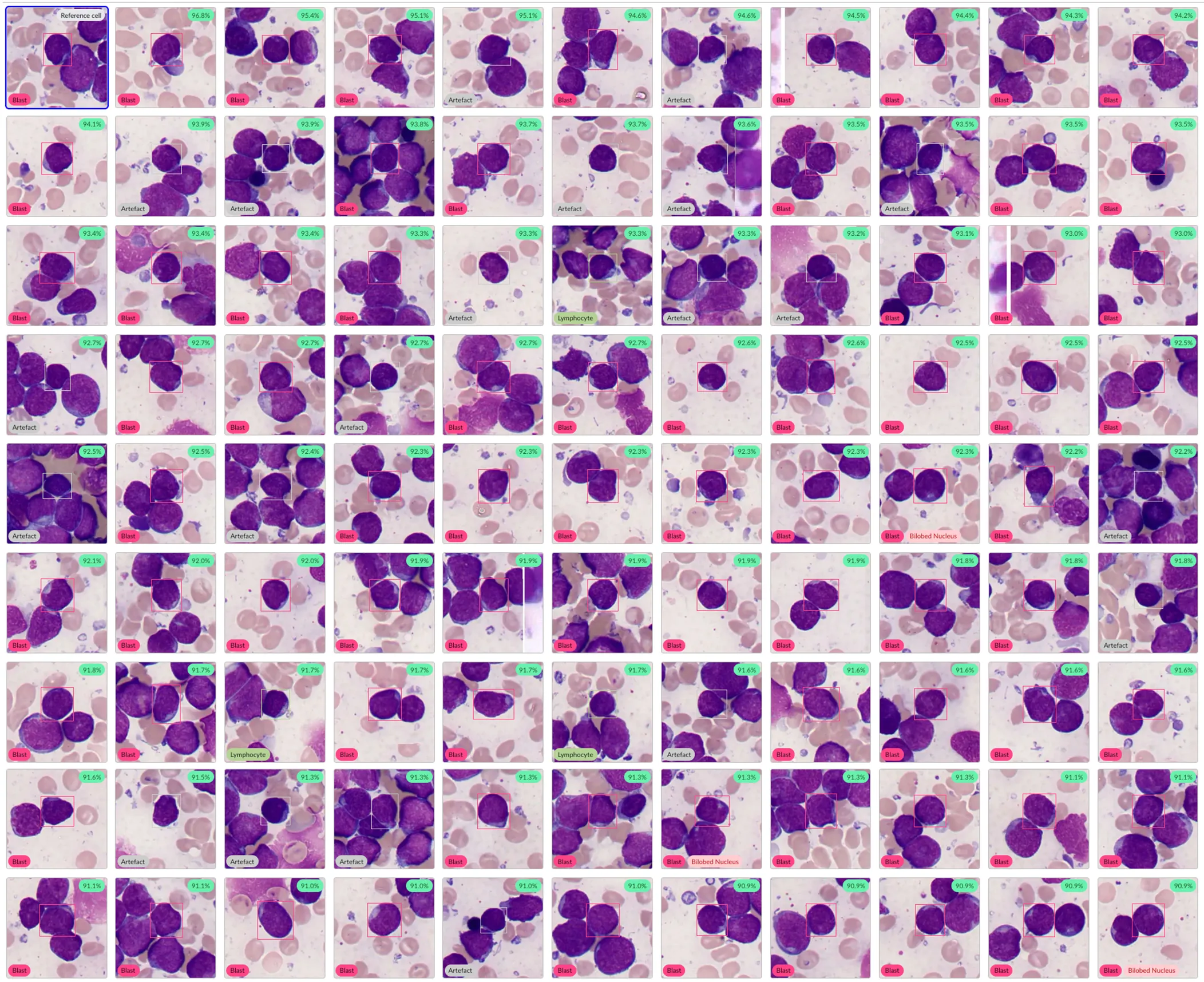 Screenshot from the Cellbytes software from view similar cells, showcasing a big grid of cells of blasts, artefacts and lymphocytes.